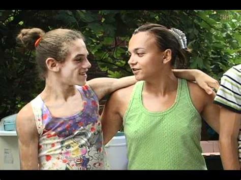 Endocrine diseases, fetal diseases, genetic diseases, rare diseases, skin diseases. Berardinelli - YouTube