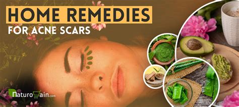 9 Easy And Best Home Remedies For Acne Scars That Work Fast