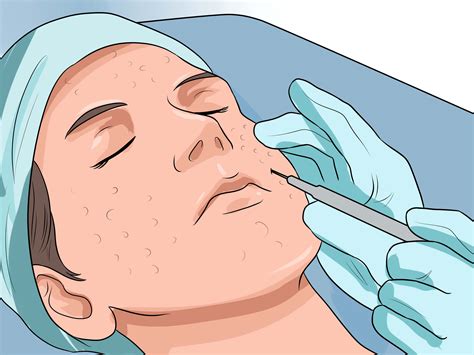 Babylon is a program that has become attached to my internet explorer, and is very pervasive. 3 Ways to Get Rid of Large Pores and Blemishes - wikiHow