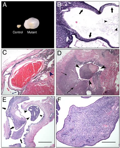 Histopathology Of Ovarian Cysts And Uterine Tumors From Brg Wap Cre