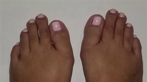 Gorgeous Before And After Toe Shortening Transformation 👠🥰 Youtube