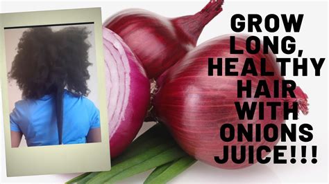 Onions Treatment For Hair Growth Youtube