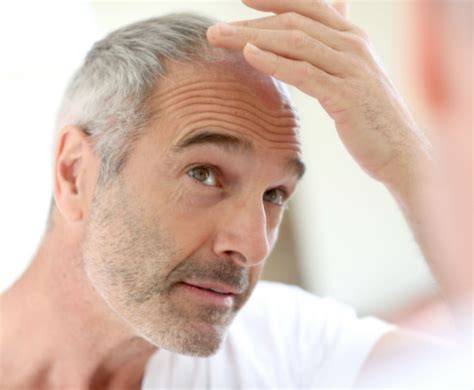 Coping With Male Pattern Baldness Enhance Medical