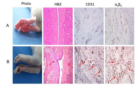 Histological Changes In Rheumatoid Arthritis A Control B Rat With