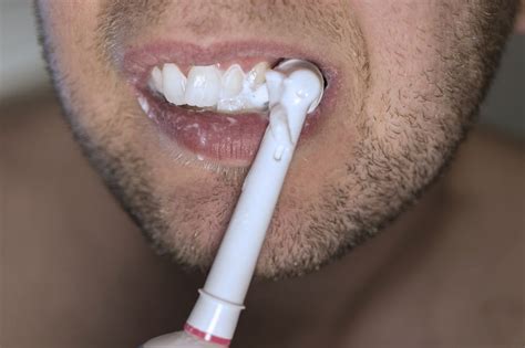 8 Mitos Dan Fakta Pemutihan Gigi Bisa Pakai Baking Soda