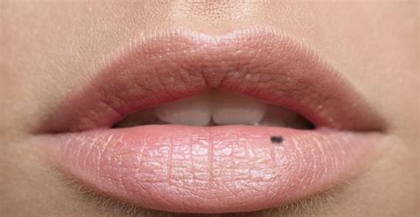 What Causes Black Spot On Your Lips New Health Advisor