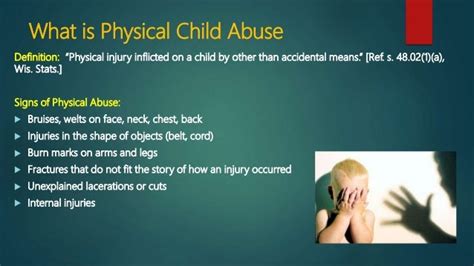 Physical Child Abuse Presentation