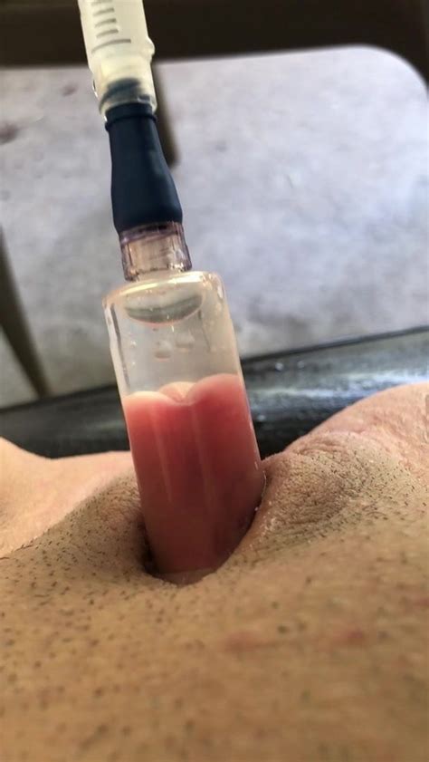 Homemade Clit Pump And Pussy Cum Free Mobile Tube Xxx Hd Porn Xhamster