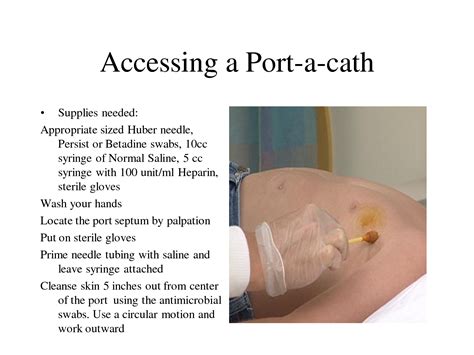 Accessing A Portacath Port A Cath Vascular Access Pinterest