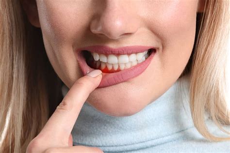 Gum Disease Find Out What It Is And How To Prevent It