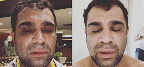  evandro santo fala da representatividade de christian pior no pânico | de tudo um jovem pan entretenimento. Evandro Santo apanha após show no interior de SP e ...