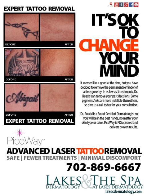 Top 195 Dermatologist Tattoo Removal