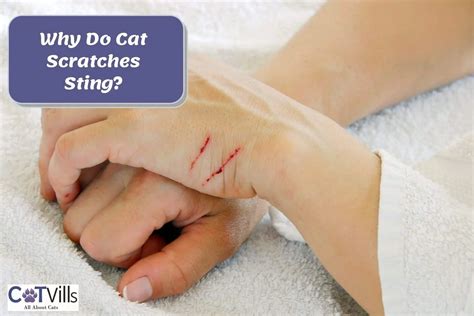 Why Do Cat Scratches Burn And Really Hurt 5 Common Reasons
