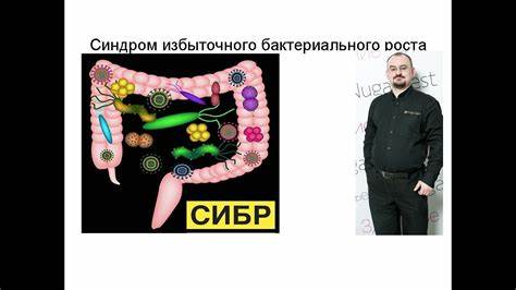 СИБР - синдром избыточного бактериального роста - YouTube Картинка - СИБР - синдром избыточного бактериального роста - YouTube