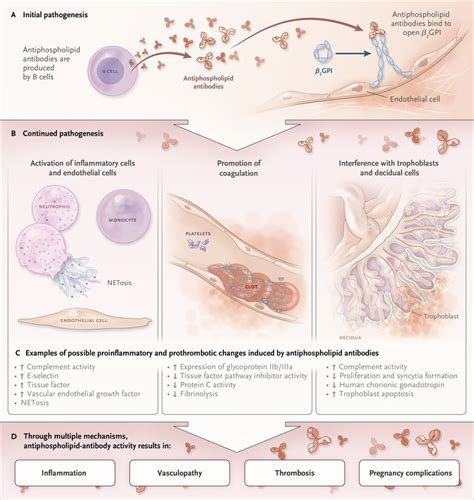Diagnosis And Management Of The Antiphospholipid Syndrome Nejm