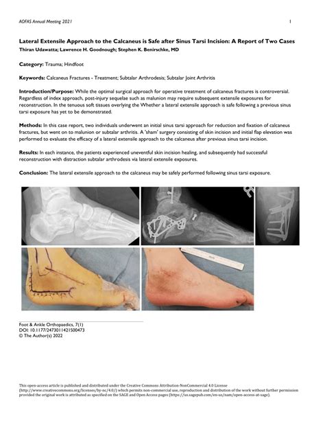 Pdf Lateral Extensile Approach To The Calcaneus Is Safe After Sinus