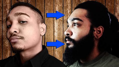The dramatic before and after results speak for themselves. 24 Men Who Grew FULLER Beards Using Minoxidil - YouTube