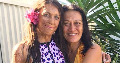 Turia Pitt My Mum Is My Role Model And Taught Me The Most Important Lesson About Life