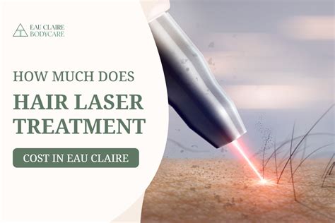 Laser Hair Removal Archives Eau Claire Body Care