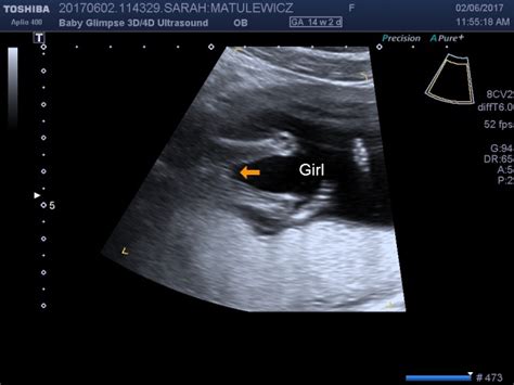 He can make faces when you are 14 weeks pregnant. 14 week ultrasound! - Glow Community