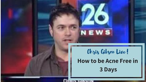 Chris Gibson Fox News Appearence About Being Acne Free In 3 Days Youtube