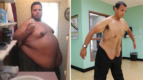 Troll To Swole Internet Bully Loses 400lbs After Changing His Ways