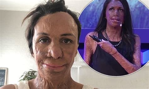 Inspirational Burns Survivor Turia Pitt Looks Back On Her Embarrassing Business Mistakes Daily