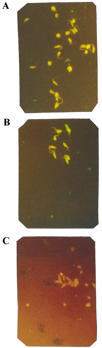 Indirect Immunofluorescence IIF Reactivity Of MAb Anti Ag163B6