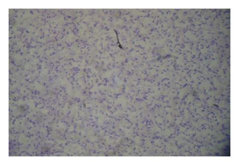 Gram Stain From The Csf Culture Reveals Ovoid Shaped Gram Positive Cocci Download Scientific