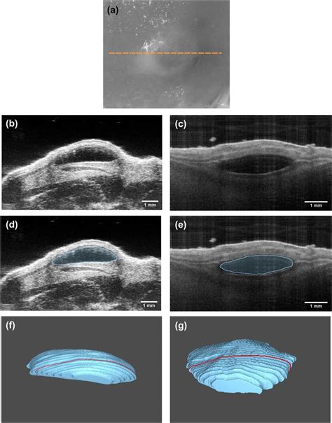 In Vivo Imaging Of The Murine Soft Tissue Filler Model Showing The