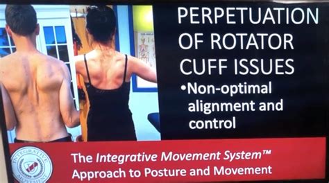 Solution To Rotator Cuff Shoulder Impingement Syndromes