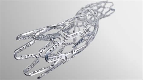 New Stents For The Future On Healthcare In