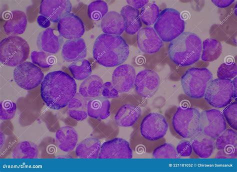 Segmented Neutrophil Cell In Human Blood Smear Stock Photo