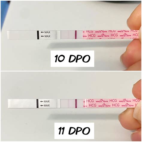 Minimal line progression 10 DPO vs 11 DPO - expected? (Easy@home HCG
