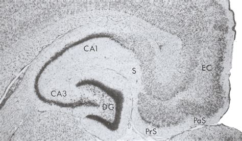 2 Coronal Section Of The Hippocampal Formation Dentate