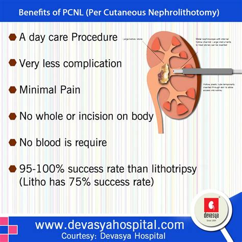 Benefits Of Pcnl Per Cutaneous Nephrolithotomy