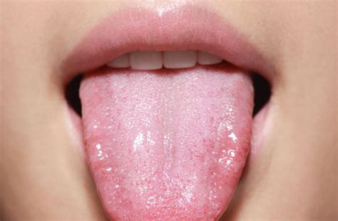 تشخیص بیماری از روی رنگ زبان در طب سنتی چگونه است؟ بیا تو صفا