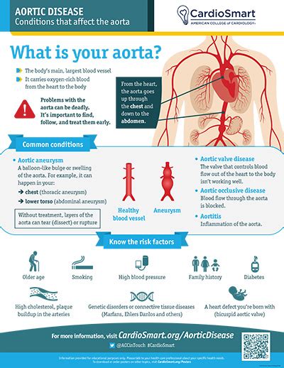 Living With Aortic Aneurysm Cardiosmart American College Of Cardiology