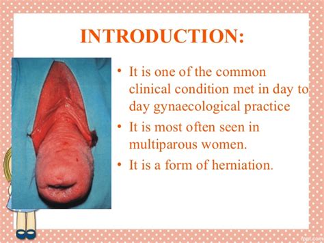 Uterine prolapse happens when vaginal childbirth or other conditions weaken the muscles and tissues of the pelvic floor so they can no longer support the. Uterine prolapse