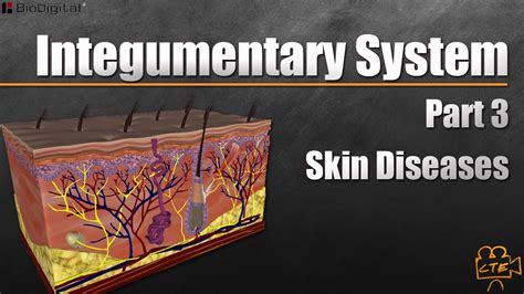Integumentary System Part 3 Of 3 Diseases Of The Skin Youtube