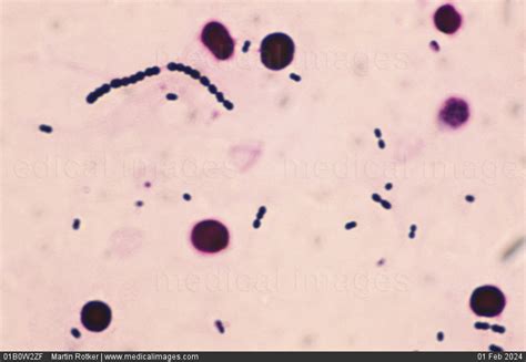 Stock Image Photomicrograph Of Streptococcus Pneumoniae Also Called