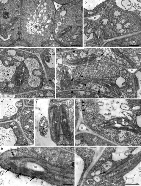 Transmission Electron Micrographs Of Glandular Parenchyma Cells Of The