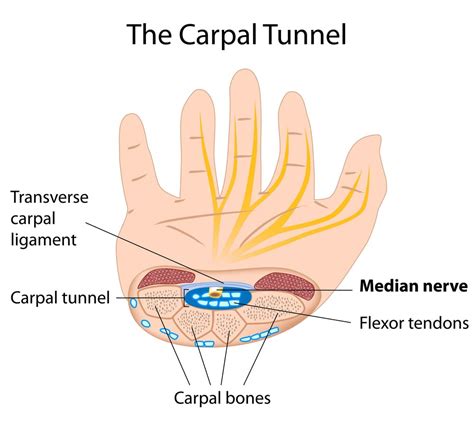Carpal Tunnel Syndrome Cts News Dentagama