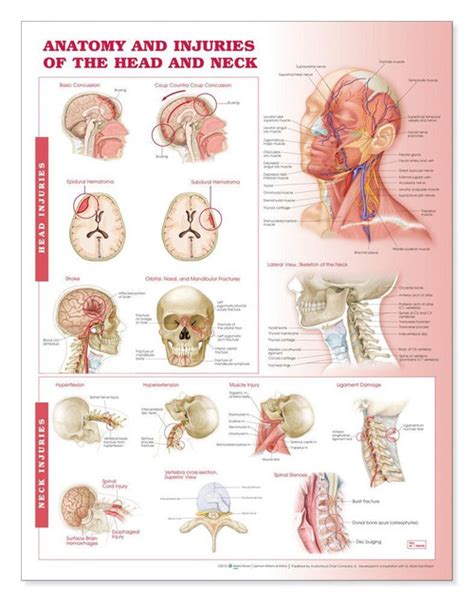 Head And Neck Injuries Anatomy Poster Clinical Charts And Supplies