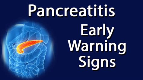 Pancreatitis Early Warning Signs Youtube