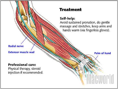 The wrist contains eight carpal bones (scaphoid, lunate, triquetrum the forearm has an anterior compartment, which consists of the flexor group of muscles innervated by the ulnar and median nerve, and a posterior. My Info Blog: Using Computer Everyday? - A Must Read ...