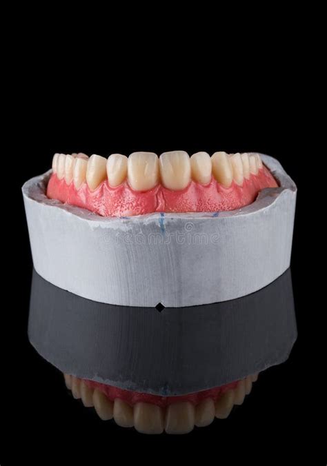 Complete Maxillary Denture Stock Image Image Of Macro 206763567