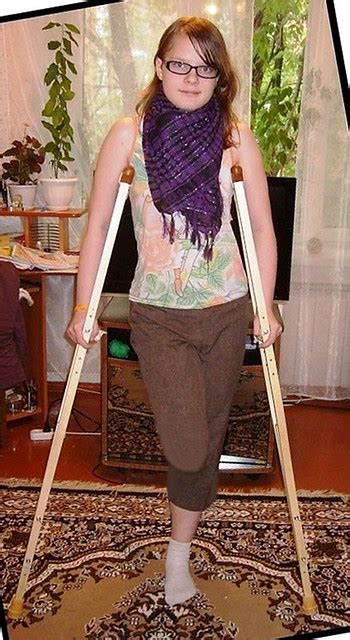 Wooden Female Amputees On Crutches
