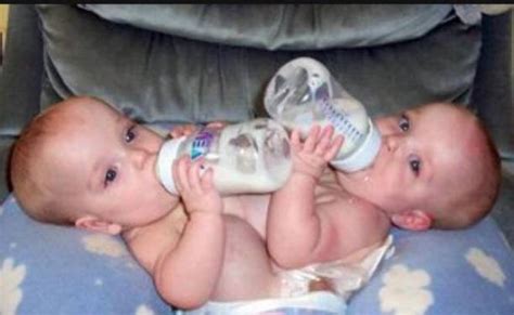 Formerly Conjoined Twins And Their Sister Enjoy Being Normal 19 Years