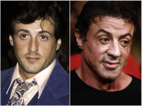 Sylvester Stallone Sylvester Stallone Plastic Surgery Celebrities